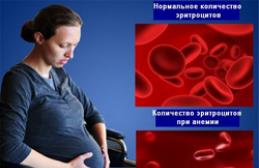 Лечение нужно беременной 32 недели анемия